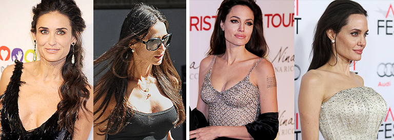 пластика груди у Деми Мур и Анжелины Джоли