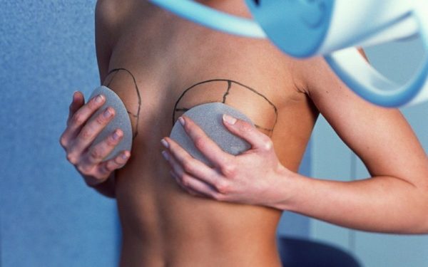 длительность операции по увеличению груди